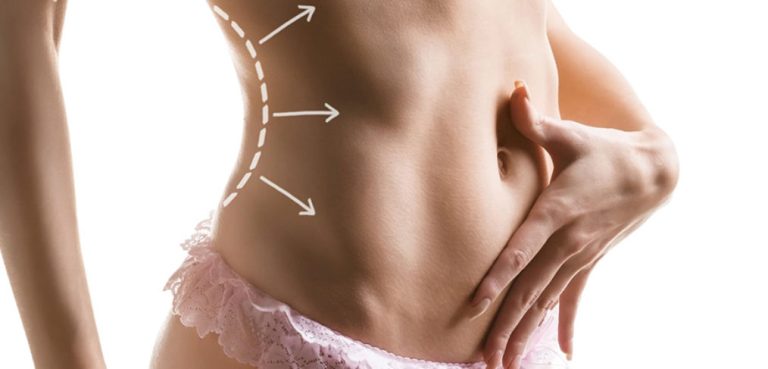 Liposuzione Roma Liposuzione Roma