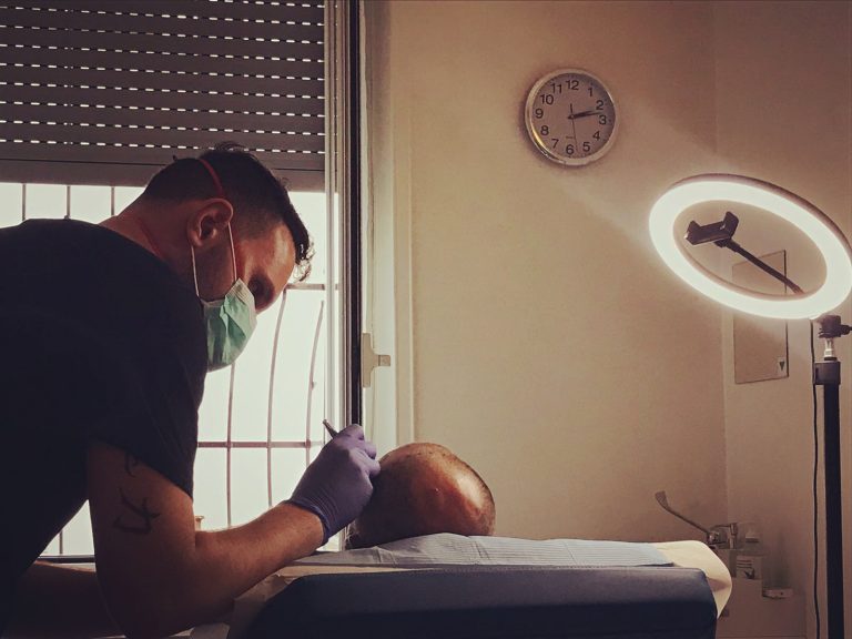 Prezzo tricopigmentazione Milano