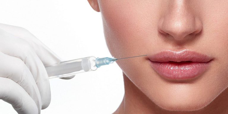 Prezzo filler Milano