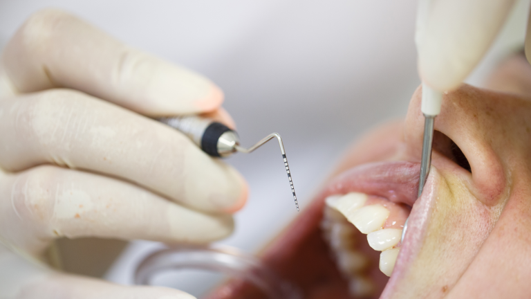 Alitosi Genova Alitosi Genova