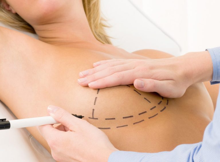 Interventi di chirurgia plastica Roma